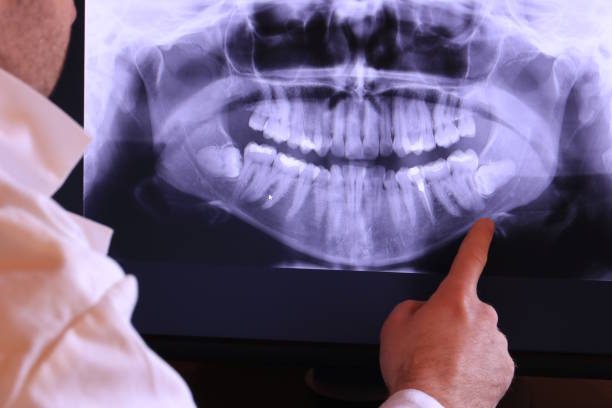 Best Tooth Infection Emergency Dentist  in Lenoir, NC