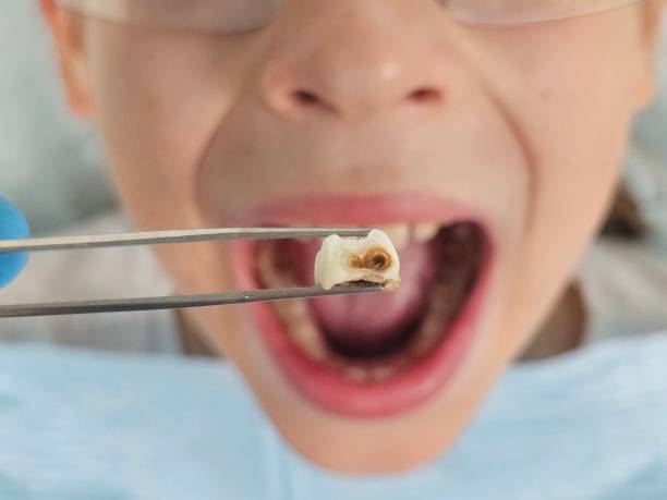 Best Tooth Infection Emergency Dentist  in Lenoir, NC
